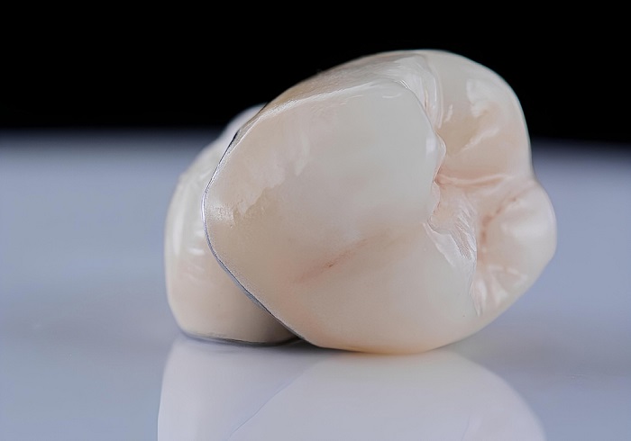 zirconia crown 